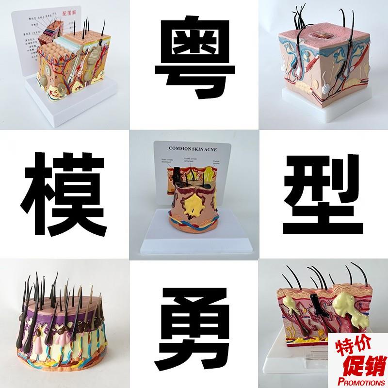 35倍人体皮肤组织结构放大解剖模型医学美容整形立体W皮肤放大模