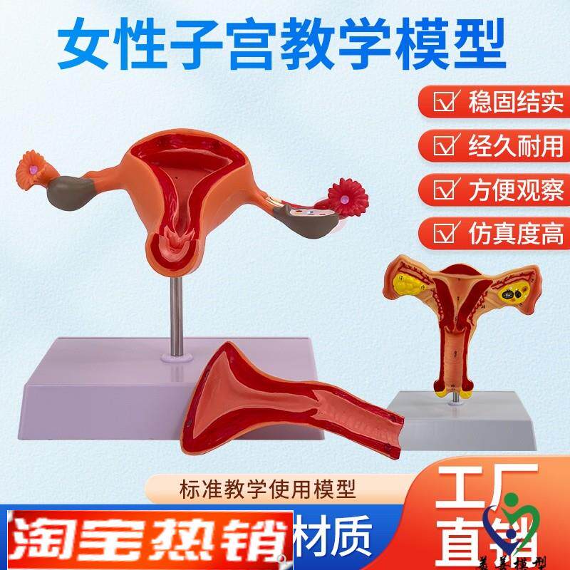 子宫模型生殖f器解剖模型计划生育示教模型妇科解剖教学医学模型
