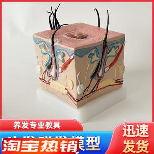 人体毛发脱发模型头发头皮发炎毛细血管毛囊收缩T教学教具演示模