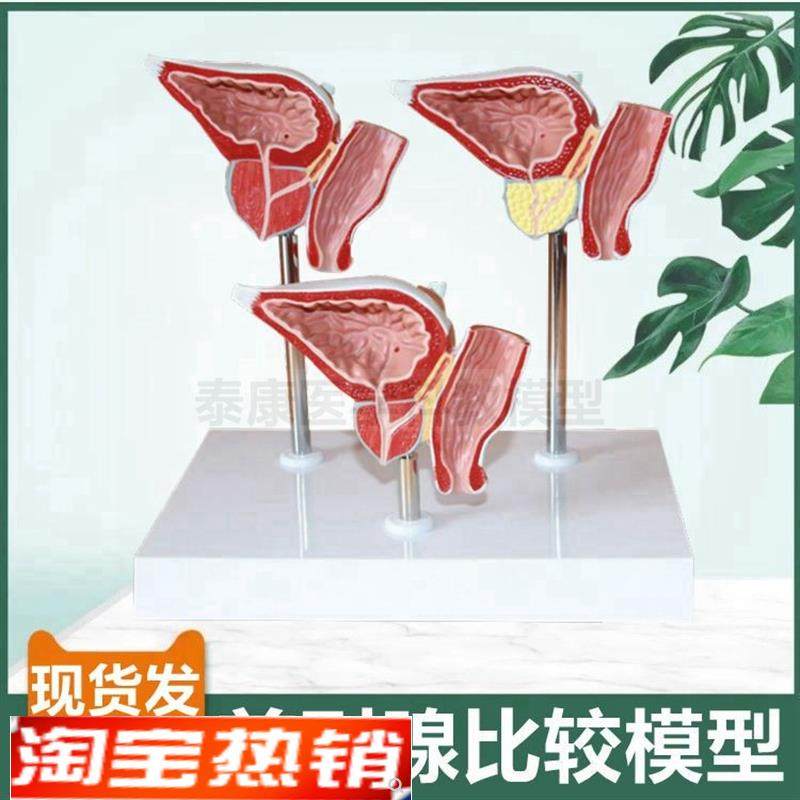 前列腺模型男科生殖泌尿器官膀胱肾脏解H剖内外生殖器睾丸内分泌