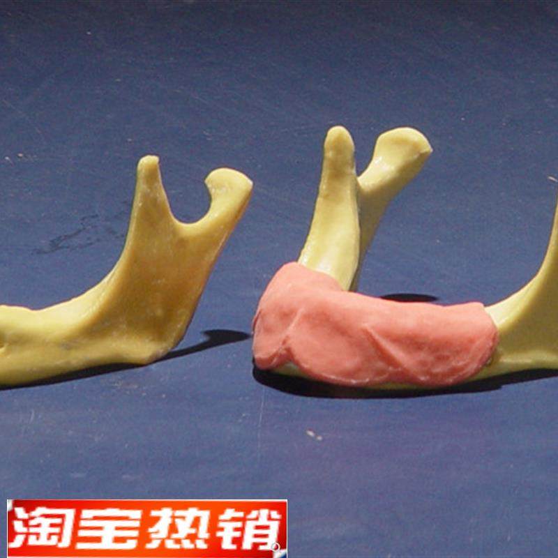 ENOVO颐诺下颌骨种植t操作模型口腔种植口腔齿科培训实训操作模,文具电教/文化用品/商务用品,教学标本/模型,淘宝优惠券,粉丝福利购,淘宝优惠卷