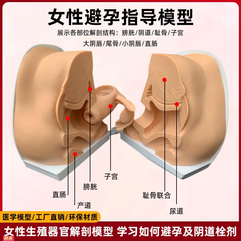 避孕指导模型女性宫内节育器上环训练妇科检查女节育计生教学教具