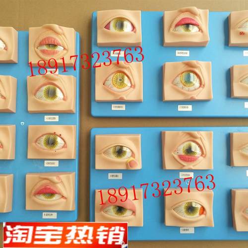 常见眼病模型20种眼睛疾病模型眼F科常见疾病模型眼球病变模型