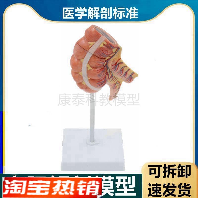 盲肠解剖模型阑尾肠o系膜淋巴血管结肠空肠回肠人体肠道病理医患