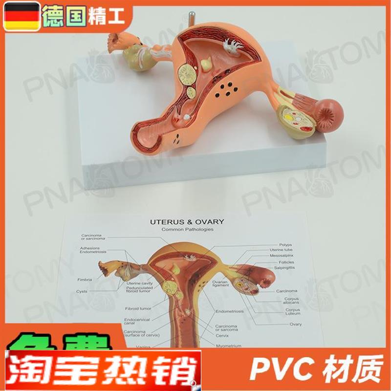 德国】女性d子宫卵巢病理病变模型生殖科妇产科教学计生医学教学