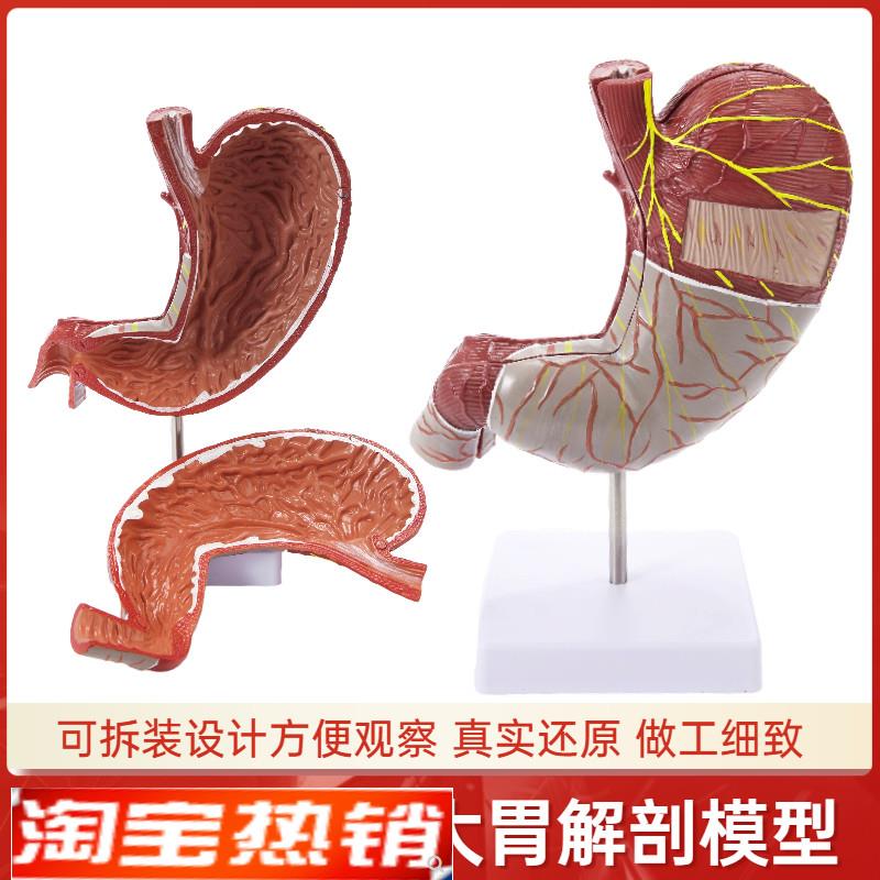 成人1.5倍放大胃解剖模型胃模型正常G胃解剖教学模型人体胃可拆卸