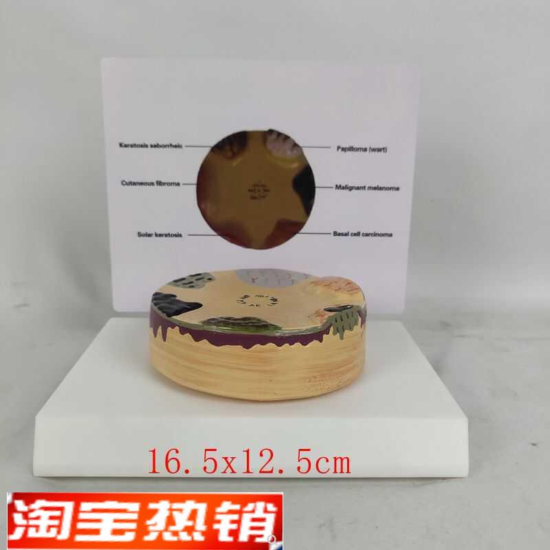 人体病理皮肤演示模型表皮皮肤解F剖模型皮肤科教具教学演示