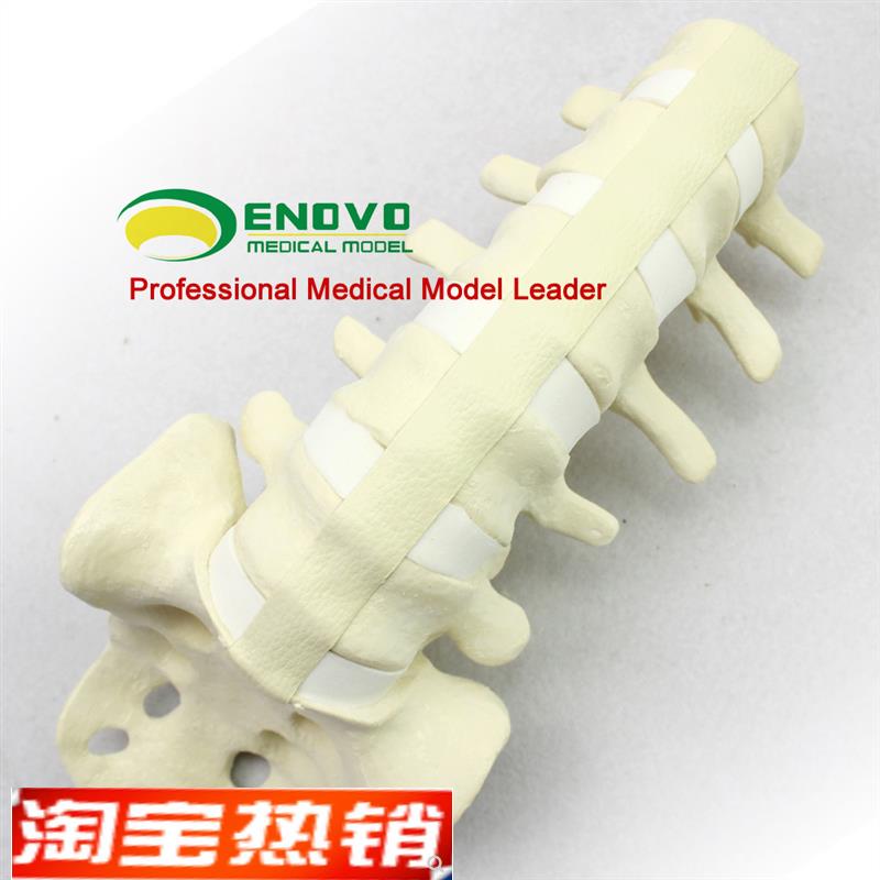 ENOVOc颐诺人体仿真腰椎尾骨模型骨科手术前Sawbone人体腰椎钉棒