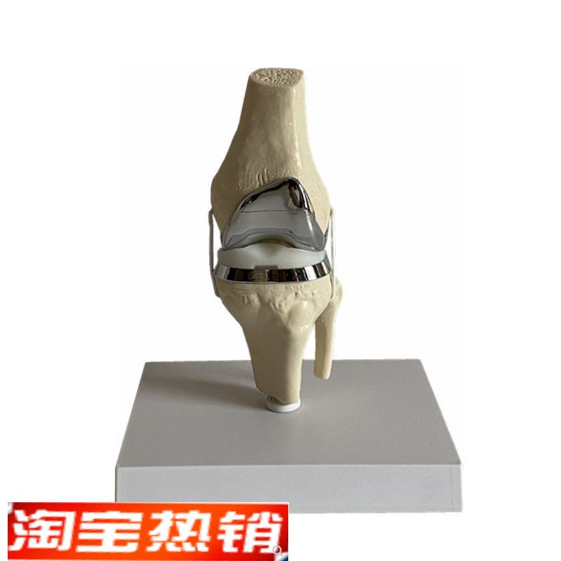 膝关节仿b真人工假肢模型半月板软骨手术示教单髁全膝置换演示医