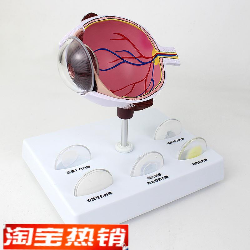 ENOVO颐诺人体眼球白内v障眼疾病瞳孔眼球体眼珠晶体医学教具白内