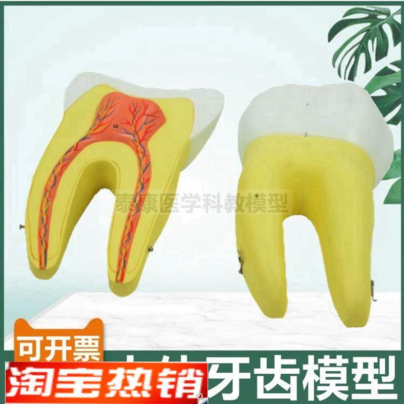 磨牙模型可拆卸切牙尖牙臼齿三只放大可拆卸N医用口腔牙齿牙医牙