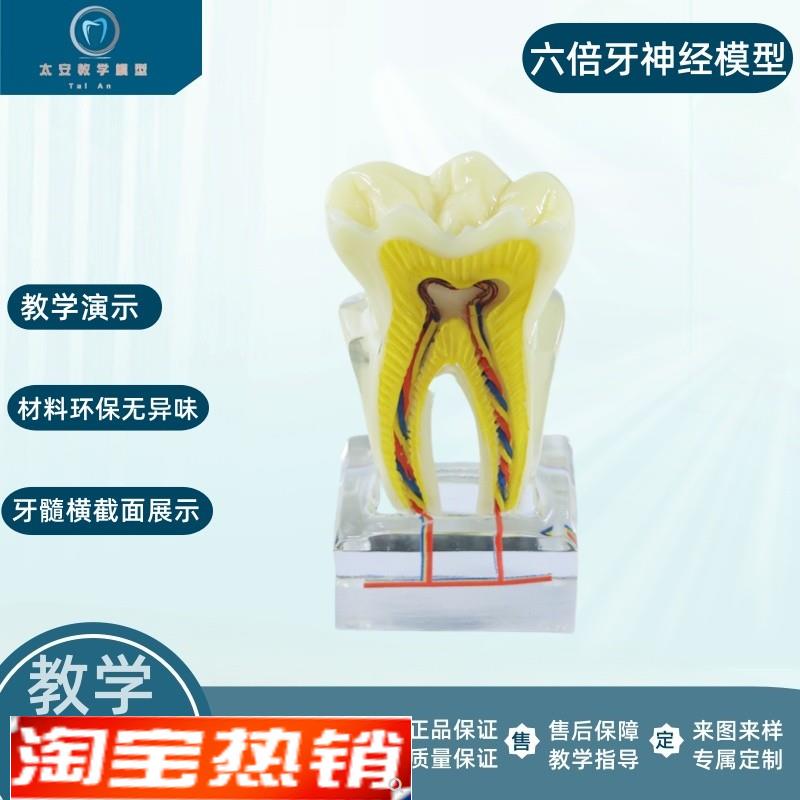 六倍龋齿模型牙齿模型牙科v模型右后牙组织分解模型六倍神经对比