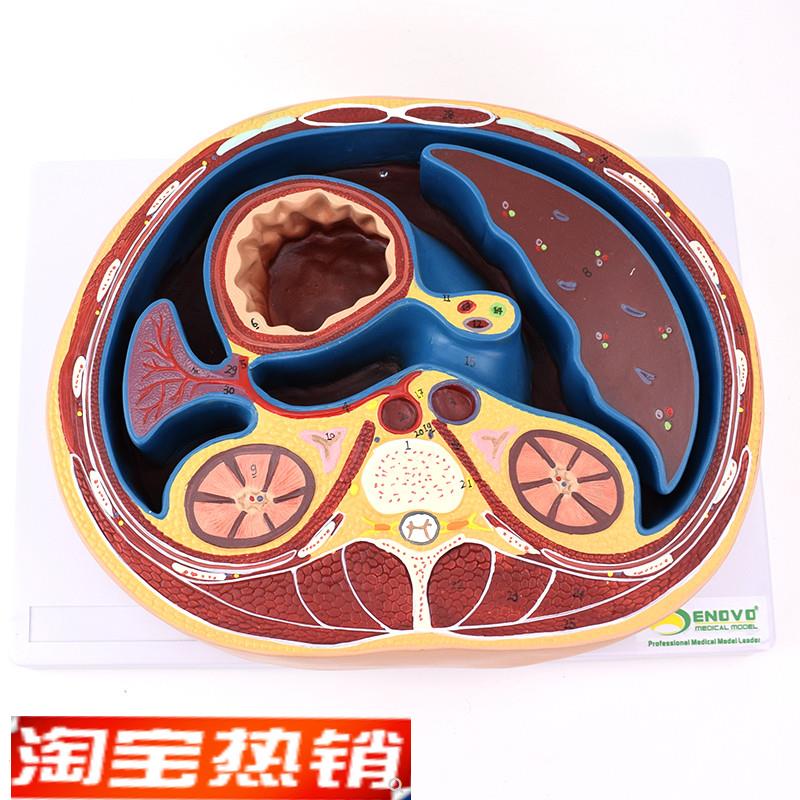 ENOVO颐诺人体腹部断面模型平网膜网膜囊孔Y结构解剖标本