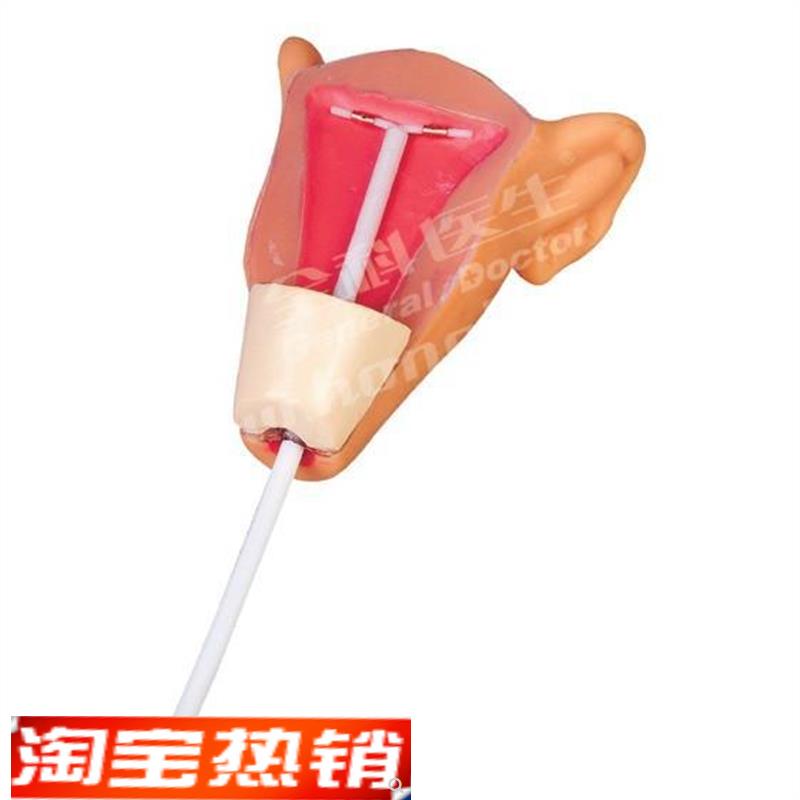 高级宫内避孕o器训练模型GD/F9E