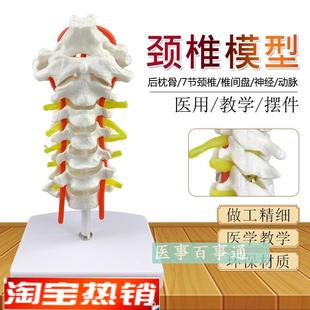 厂家直销颈椎h带颈动脉后枕骨椎间盘与神经模型颈椎模型