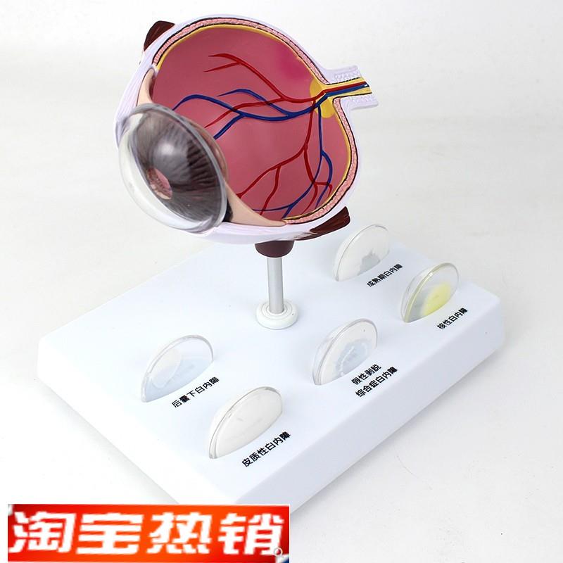 ENOVOd颐诺人体眼球白内障眼疾病瞳孔眼球体眼珠晶体医学教具