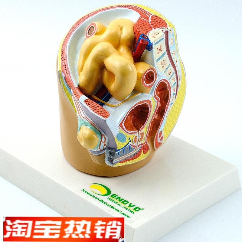 ENOVbO颐诺腹股沟疝气演示模型腹疝股疝疾病演示构疝囊解剖结构普