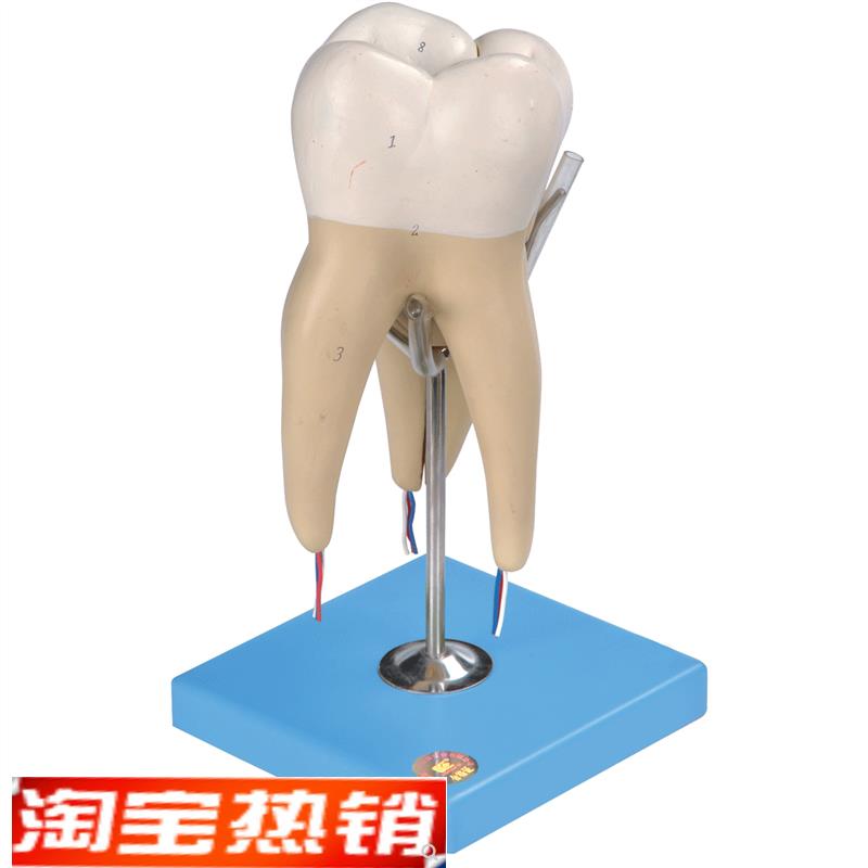磨牙有三个g牙根模型B10004/5
