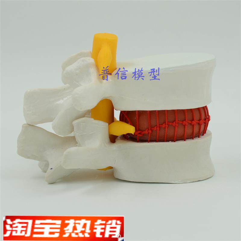 普信腰椎间盘tu出演示u模型脊柱模型医用按摩推拿腰椎模型