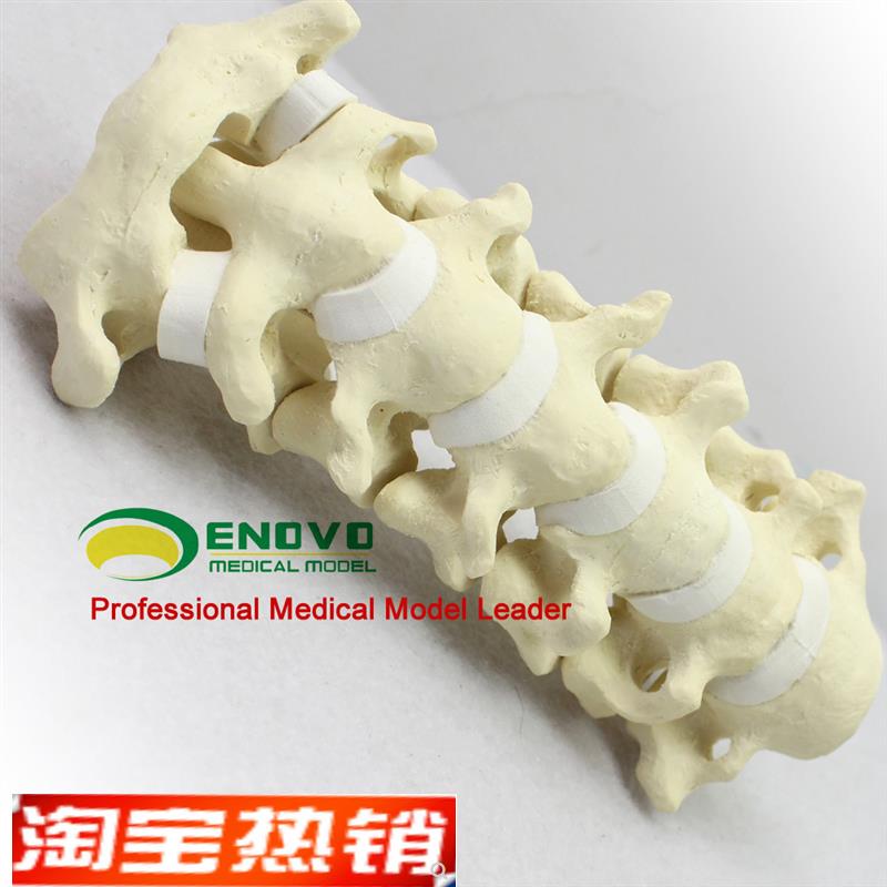 ENOVO颐诺骨科仿真人体颈椎模型医学骨科手术仿V真骨颈椎前路后