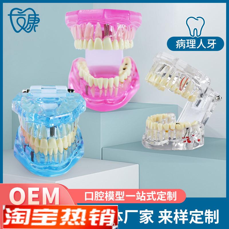 牙齿模型透明精品正常牙适合牙科医生J演示或者学生上课练习用
