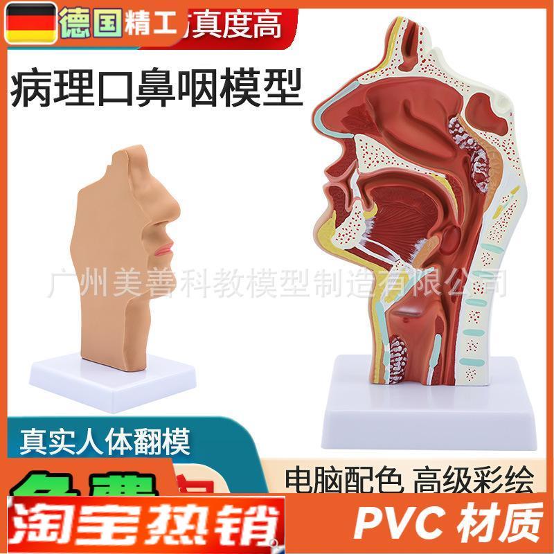病理鼻腔解剖模型耳鼻喉科教学模型鼻N腔鼻子口鼻结构模型