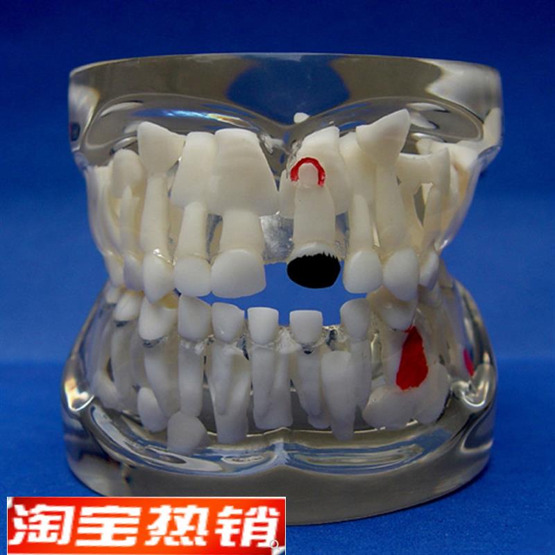 ENOVO正品儿童乳牙早期病态牙列模型牙齿发育幼儿牙X齿护理教学具