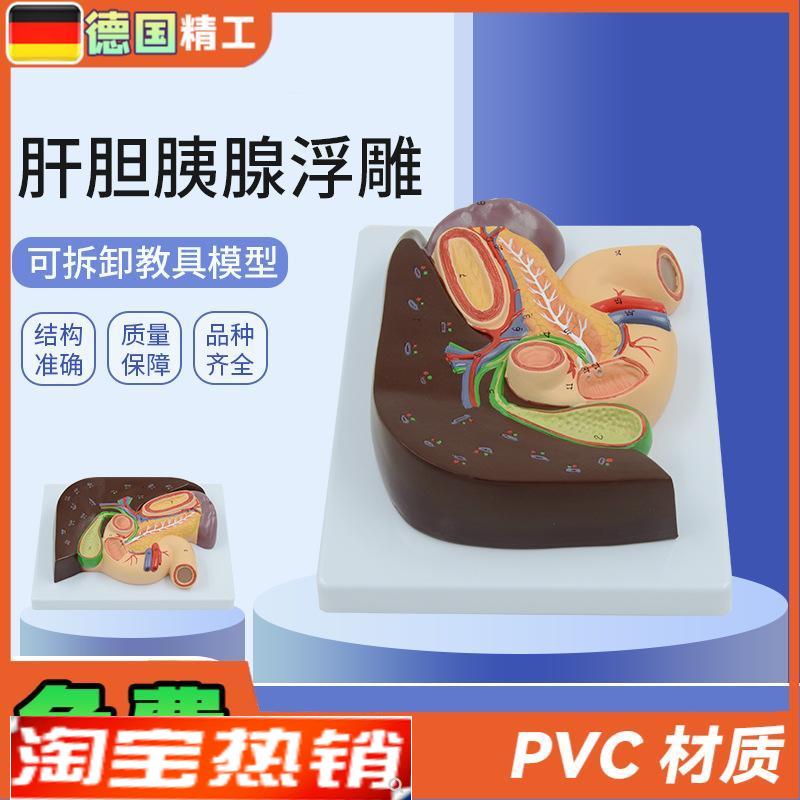 德国】人体胰腺肝脏十二指肠胆结石脾脏肝O胆解剖模型教学内科