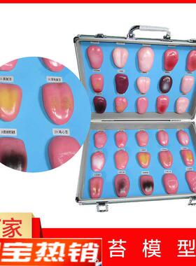 人体舌头舌苔模型常见病舌苔病变比较中医口P腔望诊教学解剖模型