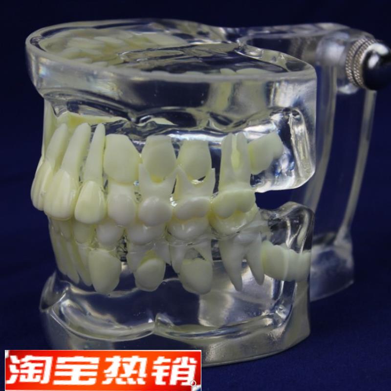 ENOVbO颐诺全透明乳恒牙交替模型儿童牙齿列发育指导刷牙模型