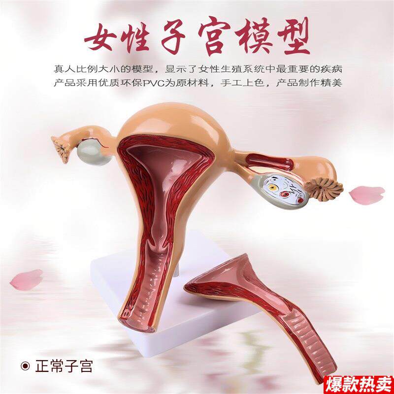 女性子宫模型卵巢模型女性阴S道女性内生殖器解剖模型妇科教具