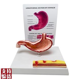 人体胃部消化系统解剖r模型内脏解剖胃炎教学医学教具厂家直销