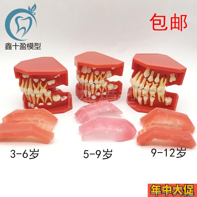 儿童乳牙替换牙齿模型 乳恒牙w交替3个阶段 口腔5-9髓牙列发育模