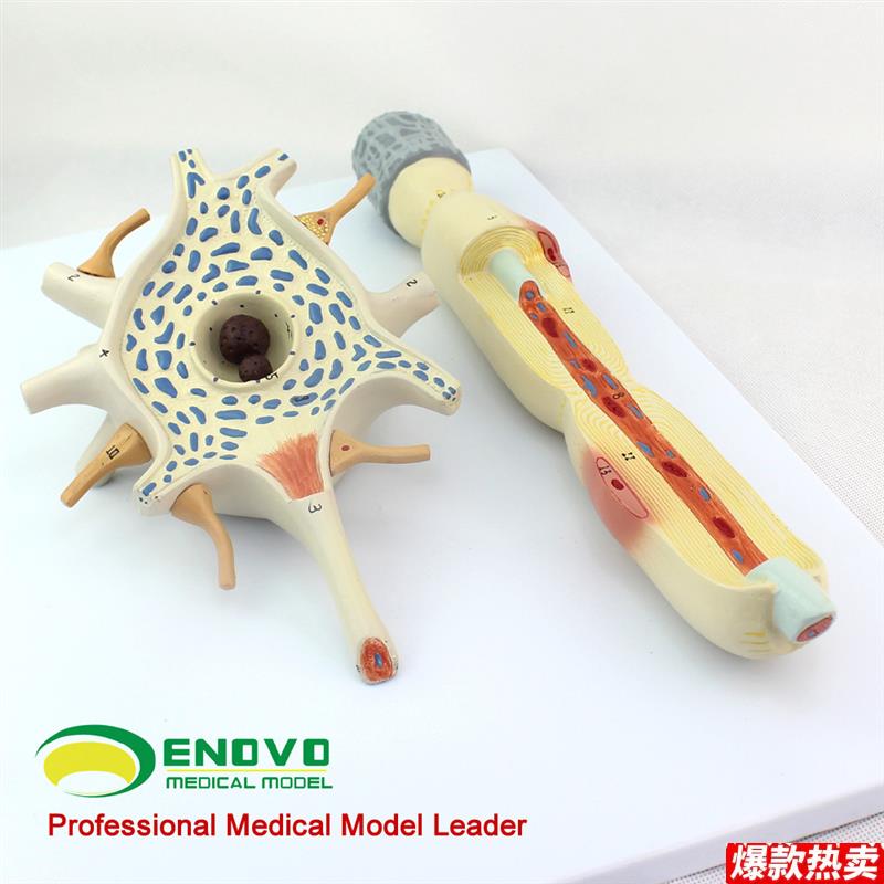 颐诺正品神经元胞体和m神经纤维结构放大模型医用人体解剖系统