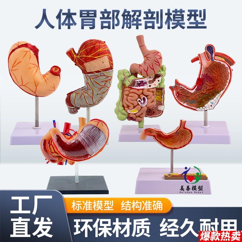 教学仿真人体胃解剖模型胃放O大胃部疾病演示病理胃带横隔胃的穿