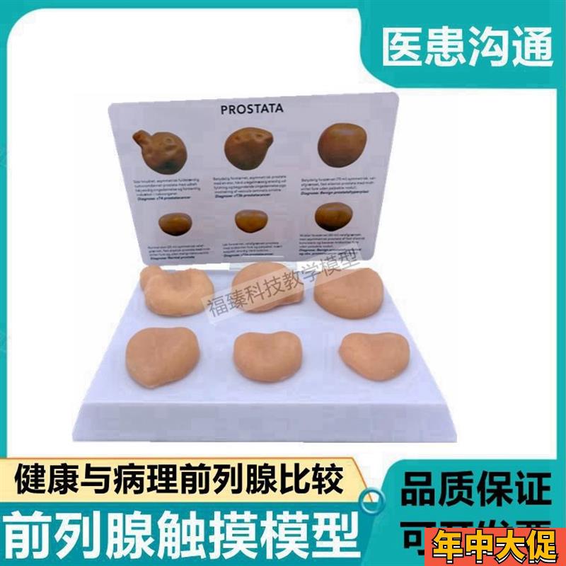 前列腺触摸模型自检健康病理不同年龄F段男科医患膀胱泌尿生殖肥