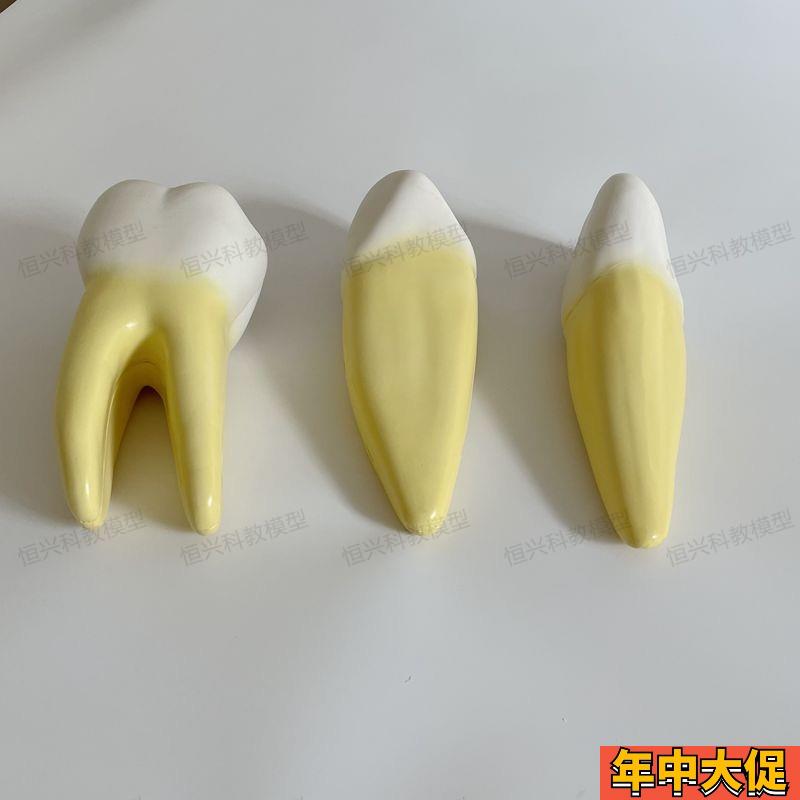 磨牙切牙拆卸牙龈神经p解剖模型牙科医患沟通口腔建模素材牙齿结