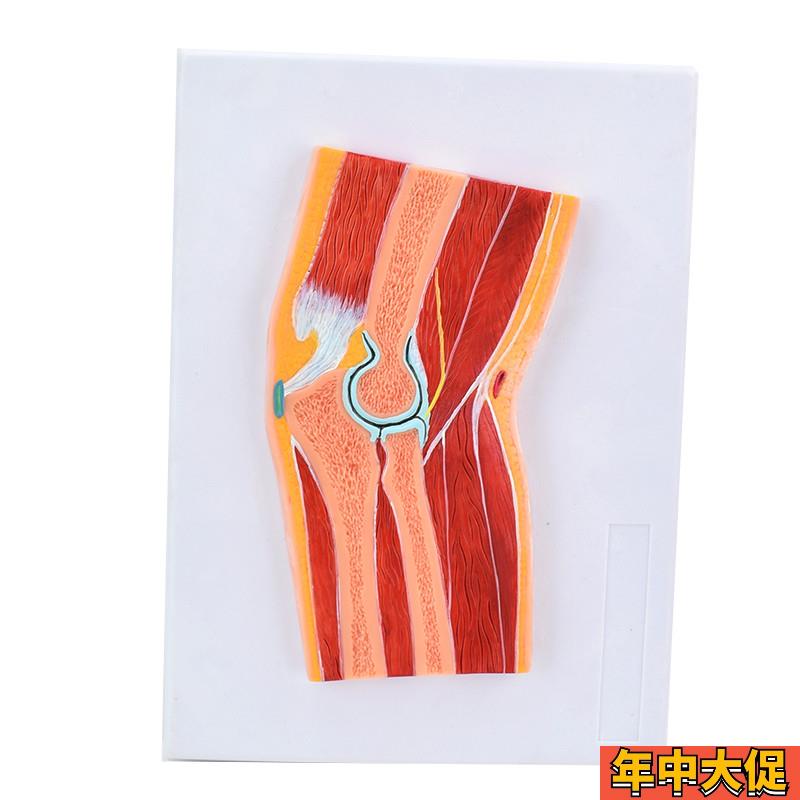 ENOVO颐诺肘关节骨骼肌肉模型肘关节构造MRI关节V 解剖骨科教学