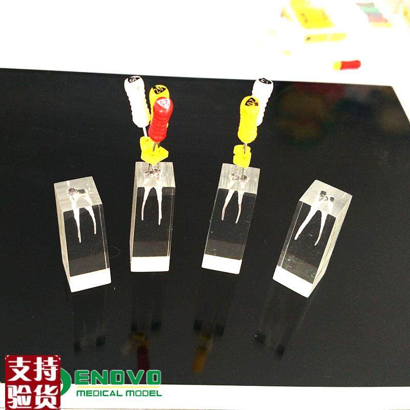 ENOVbO颐诺牙体牙髓教学实践模型根管练习预备充填练习RCT口外操,文具电教/文化用品/商务用品,教学标本/模型,淘宝优惠券,粉丝福利购,淘宝优惠卷