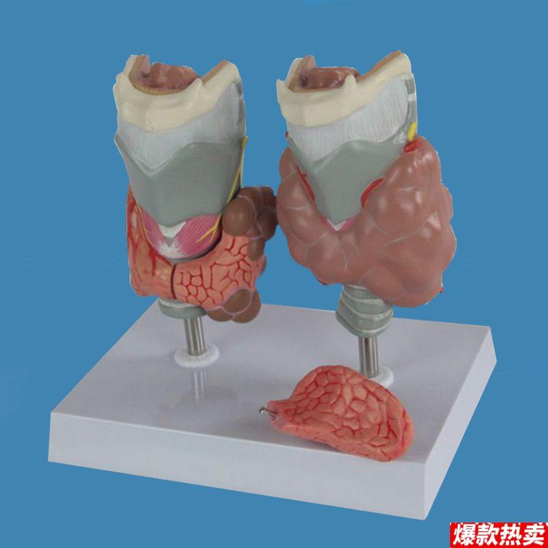 内分泌系统模型甲状腺喉咙结节甲减e甲亢病理囊大肿生理医药促销
