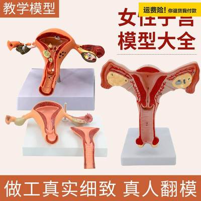 .子宫、卵巢病理病变模型生殖科医药礼品模型女性子宫阴道模