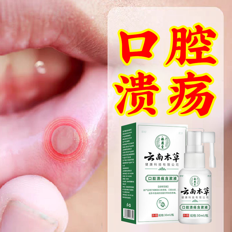 云南本草口腔溃疡专用喷剂复发性保健理疗