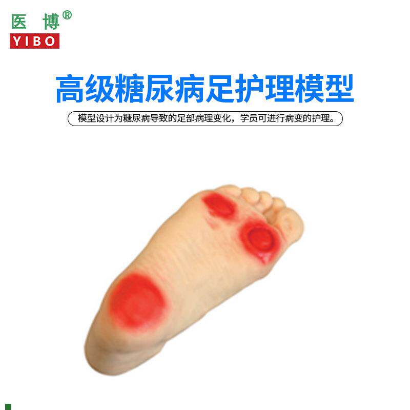 医博BIX-HS19糖尿病足y护理模型足部病理展示示教模型教具
