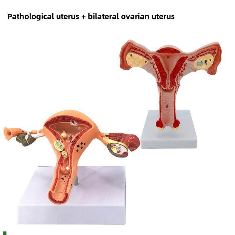 女性生殖模器模型女性生殖模器模型私密子宫模型教具妇Z科卵巢解