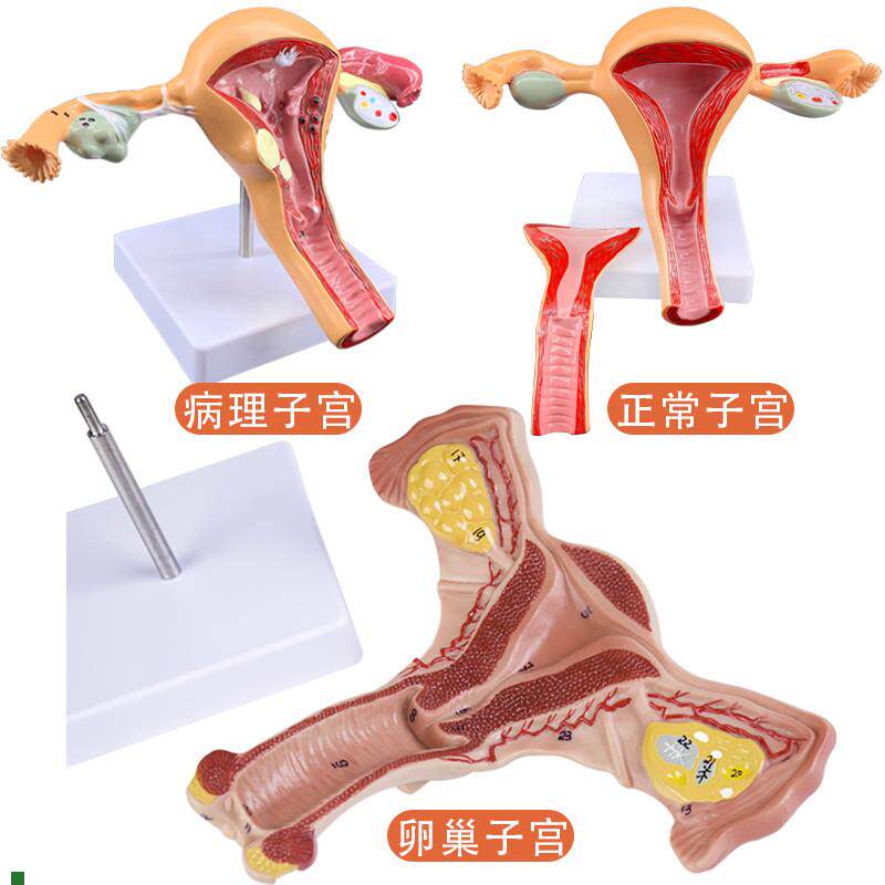 人体模型女性生殖子宫模型阴道卵巢模型教学N模具子宫病理演示模