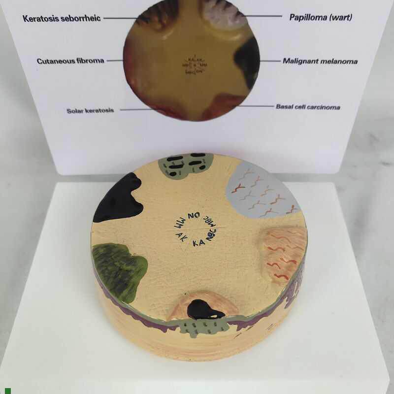 人体皮肤解剖模型病理r皮肤演示皮肤科教具多症状皮肤病演示