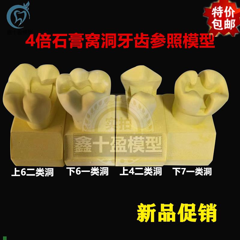 牙科4倍制备窝h洞对照雕刻参照牙齿模型石膏牙齿四倍二类洞一类洞