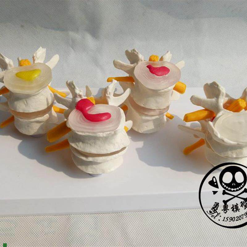 人体骨骼椎间盘演示模型正常腰椎组合模型人体骨骼W模型人体模型