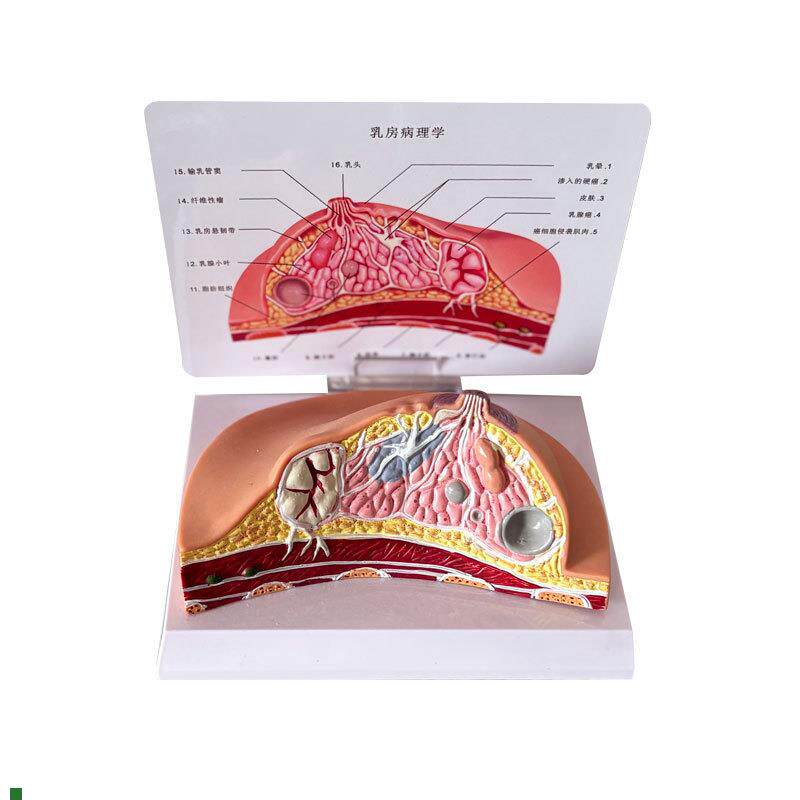 乳房模型乳腺增生家政培训妇产乳腺演示哺乳期乳房构W造催乳师教