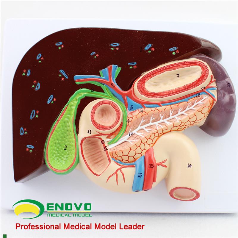 颐诺人体肝胆胰十二指肠胃u结构模型消化科医用Whipple模型